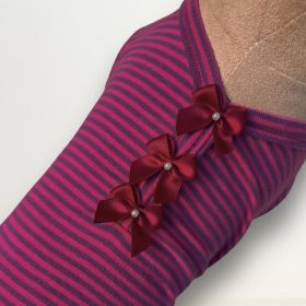 Sweet Dreams Dog Pajamas (Color: Striped Pink, size: XS)